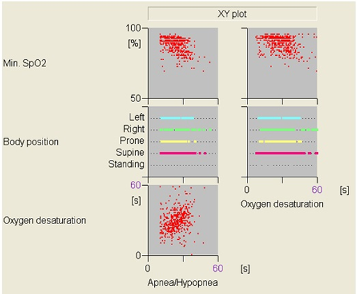 SCM-510W-Fukuda Denshi-ECG Holter softwave5.jpg